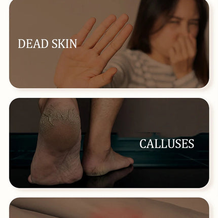 Détache-callosités électrique – Meuleuse à pieds numérique